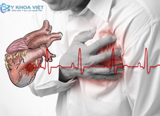 Suy tim và Glycosid trợ tim