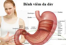 Sinh lý bệnh hệ tiêu hóa.