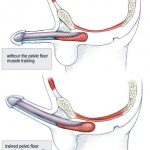 Những điều cần biết về nguyên nhân rối loạn cương dương
