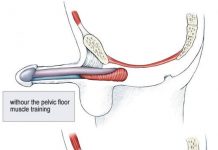 Những điều cần biết về nguyên nhân rối loạn cương dương