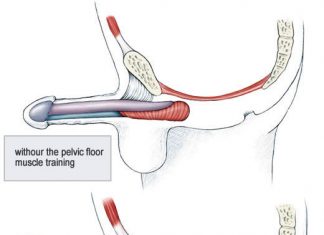 Những điều cần biết về nguyên nhân rối loạn cương dương