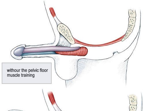 Những điều cần biết về nguyên nhân rối loạn cương dương