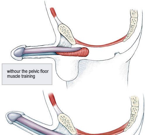 Những điều cần biết về nguyên nhân rối loạn cương dương