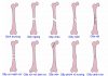 Chẩn đoán cận lâm sàng trong khám xương.