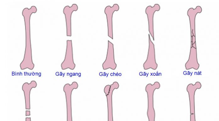 Chẩn đoán cận lâm sàng trong khám xương.