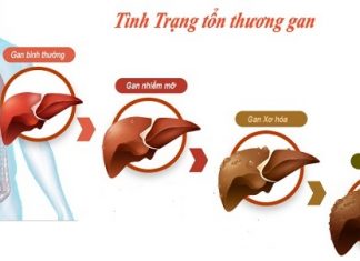TẾ BÀO VÀ MÔ HỌC TRONG BỆNH GAN