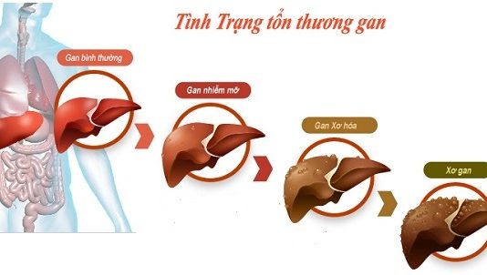 TẾ BÀO VÀ MÔ HỌC TRONG BỆNH GAN