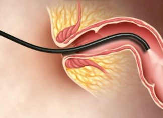 Kỹ thuật nội soi đại tràng