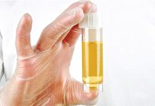 Các xét nghiệm cận lâm sàng phát hiện tình trạng thai nghén