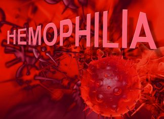 Triệu chứng lâm sàng và chẩn đoán bệnh Hemophilia