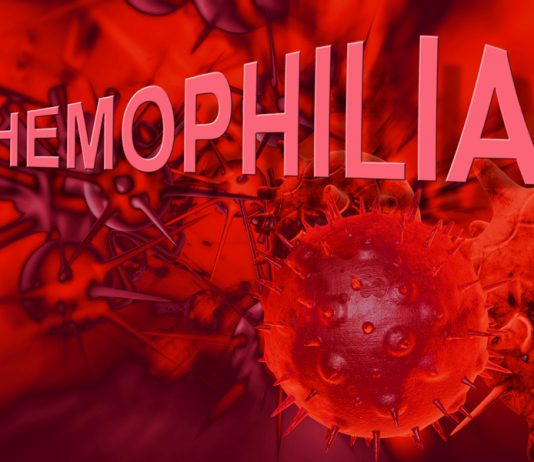 Triệu chứng lâm sàng và chẩn đoán bệnh Hemophilia