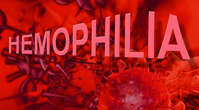 Triệu chứng lâm sàng và chẩn đoán bệnh Hemophilia