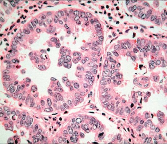 Một số thăm dò cận lâm sàng giúp chẩn nguyên nhân gây suy thận cấp