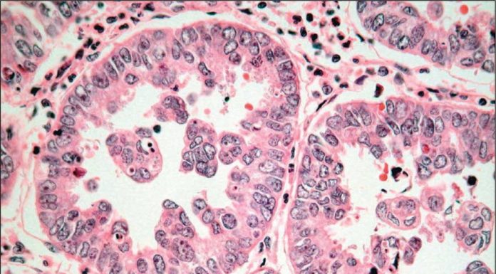 Một số thăm dò cận lâm sàng giúp chẩn nguyên nhân gây suy thận cấp