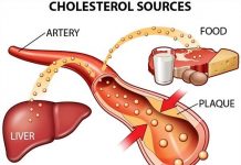 Lipid máu