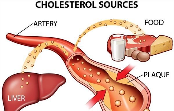 Tổng quan về lipid máu Lipid máu