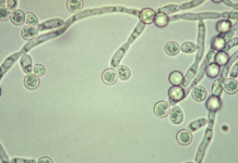 Điều trị bệnh nấm Candida