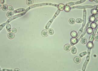 Điều trị bệnh nấm Candida