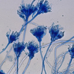 Độc tố nấm Aflatoxin