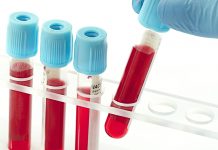 Xét nghiệm máu và ý nghĩa lâm sàng