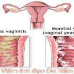 Các bài thuốc thanh nhiệt giải độc trong y học cổ truyền