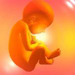 Cận lâm sàng trong chẩn đoán đau dây thần kinh tọa