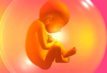 Cận lâm sàng trong chẩn đoán đau dây thần kinh tọa