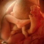 Chẩn đoán và xử trí đẻ khó do sa dây rau-những điều cần biết