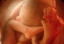 Chẩn đoán và xử trí đẻ khó do sa dây rau-những điều cần biết