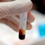 Các bài thuốc thẩm thấp lợi niệu trong y học cổ truyền