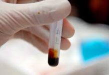 Các bài thuốc thẩm thấp lợi niệu trong y học cổ truyền