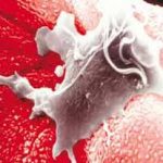 Các bài thuốc hồi dương cứu nghịch trong y học cổ truyền