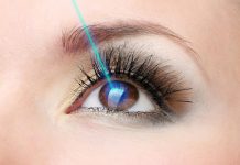 Có nên phẫu thuật lasik để điều trị tật khúc xạ?