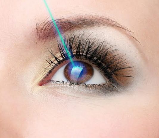 Có nên phẫu thuật lasik để điều trị tật khúc xạ?