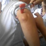 Phương pháp khám trương lực cơ.