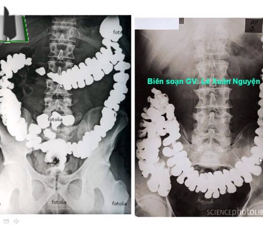 THĂM DÒ HÌNH THÁI ĐƯỜNG TIÊU HÓA BẰNG PHƯƠNG PHÁP CHỤP X QUANG