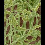 Biểu hiện bệnh da do nấm sợi nấm sợi