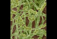 Điều trị bệnh da do nấm sợi nấm sợi