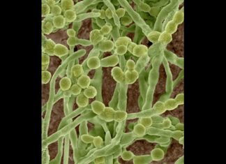 Điều trị bệnh da do nấm sợi nấm sợi