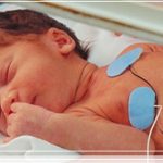 Bệnh hẹp động mạch chủ.