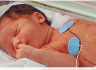 Các dị tật động mạch phổi.