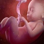 Một số nguyên nhân gây thiểu ối và triệu chứng lâm sàng cần biết