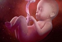 Một số nguyên nhân gây thiểu ối và triệu chứng lâm sàng cần biết