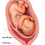 Chảy máu sau sinh do các bệnh lý thời kỳ sổ rau-những điều cần biết