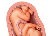 Chảy máu sau sinh do các bệnh lý thời kỳ sổ rau-những điều cần biết