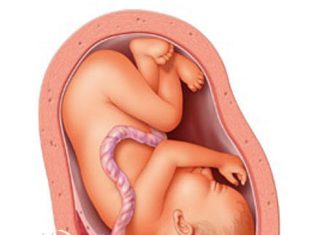 Chảy máu sau sinh do các bệnh lý thời kỳ sổ rau-những điều cần biết