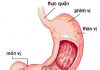 Kiến thức chung về dạ dày