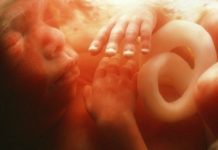 Một số phương pháp điều trị thiểu ối chị em cần biết