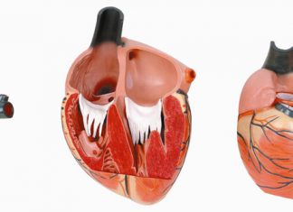 Nghiên cứu đại thể bệnh viêm nội tâm mạc nhiễm khuẩn.