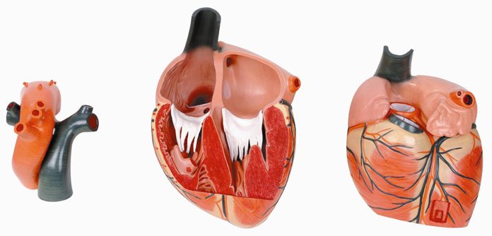 Nghiên cứu đại thể bệnh viêm nội tâm mạc nhiễm khuẩn.